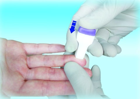 PIC SAFE DIGITEST PLUS 28G 1,5 mm Nakłuwacze bezpieczne, 100 szt. PIC SAFE DIGITEST PLUS 28G 1,5 mm Nakłuwacze bezpieczne, 100 szt.